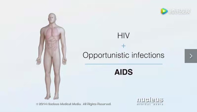 人在感染了HIV病毒后不一定会马上发病，会经过0.5～20年（平均7～10年）的潜伏期，这段时间被称为HIV感染者；只有在发病之后，这个人才能被称为艾滋病患者。